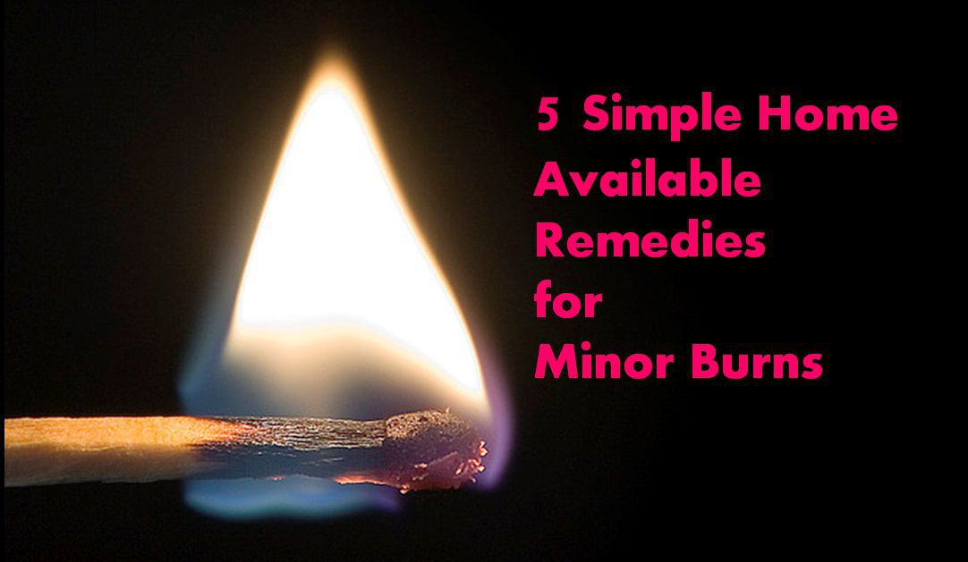 Home Remedies For Kitchen Burns Home Remedies For Kitchen Burns