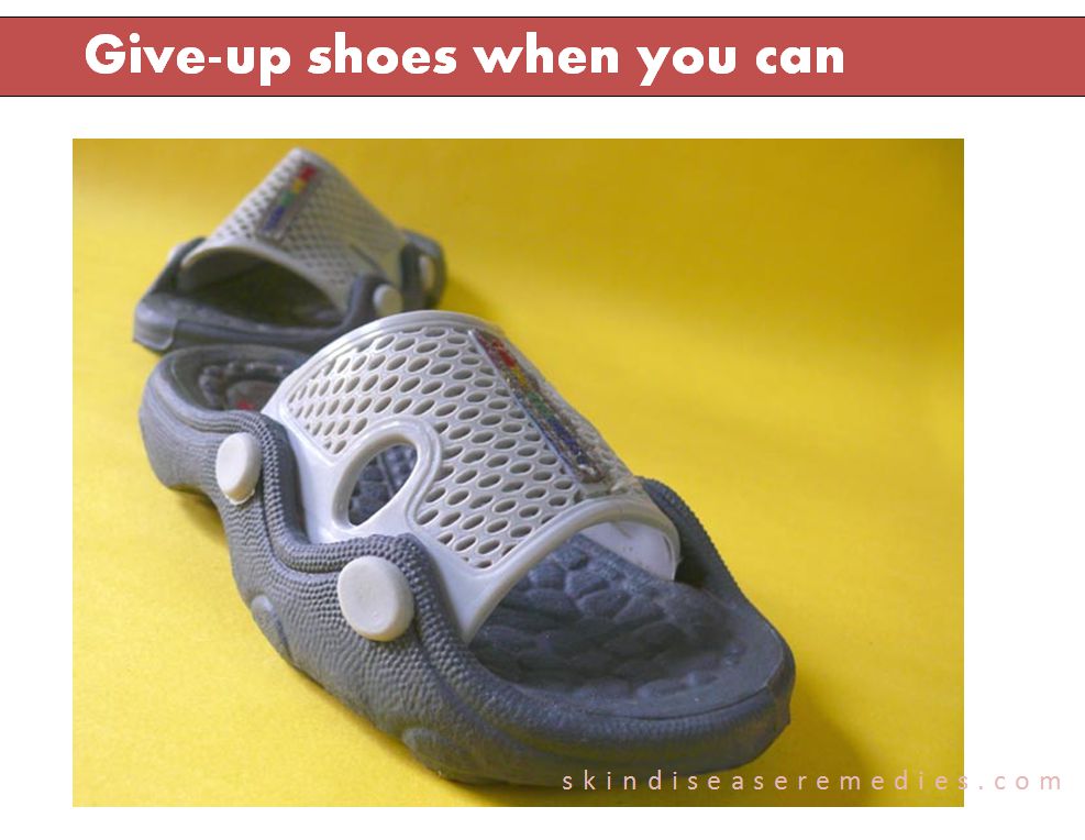 How to Get Rid of Shoe Odor