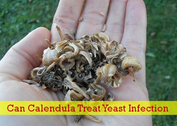 skin infection home remedy calendula for yeast infection skin disease remedies skin infection home remedy calendula for yeast infection skin disease remedies