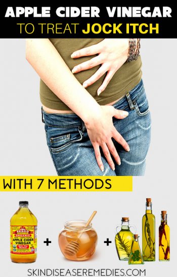 How to Use Apple Cider Vinegar for Jock Itch - 7 Methods Included