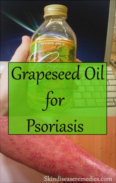 Grapeseed Oil for Psoriasis - 3 Effective Recipes - Skin Disease Remedies